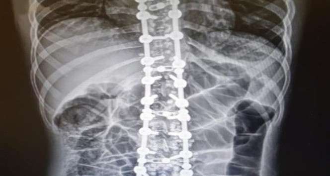 'Osteopati tedavisinde hastalık yoktur, hasta vardır'