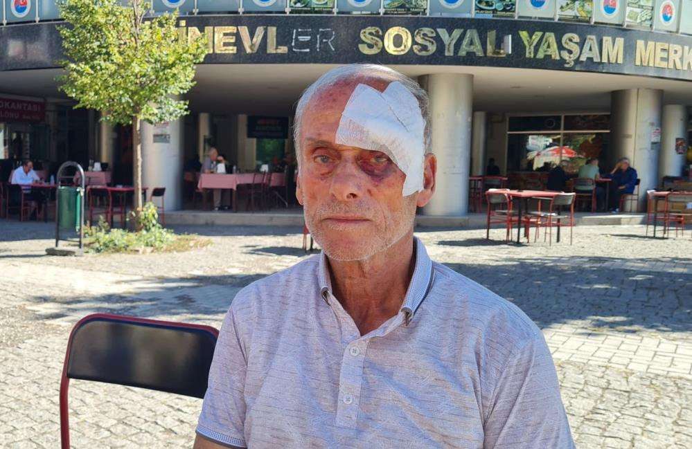 57 yıllık CHP üyesi parti binasında dövüldü